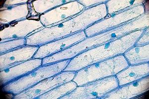A group of onion cells is shown. Each cell has a visible cell wall and nucleus.