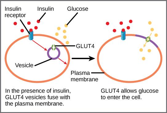 When insulin in the bloodstream binds the insulin receptor in the plasma membrane of a target cell, a vesicle containing the glucose transporter Glut-4 fuses with the plasma membrane. Glut-4 is a transporter that allows glucose to enter the cell.