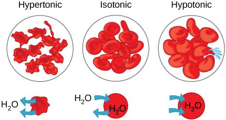 The left part of this illustration shows shriveled red blood cells bathed in a hypertonic solution. The middle part shows healthy red blood cells bathed in an isotonic solution, and the right part shows bloated red blood cells bathed in a hypotonic solution.