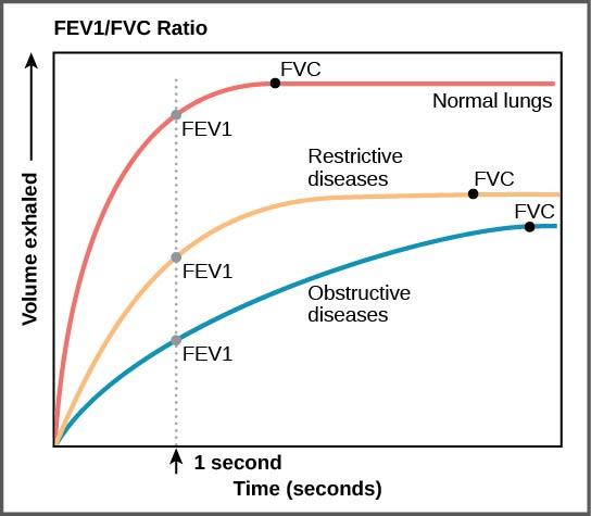 The graph plots volume exhaled versus time. In normal lungs, almost all of the air can be forcibly exhaled within one second after taking a deep breath, resulting in a curve that rises steeply at first then plateaus shortly after one second. The volume at which the plateau is reached is the FVC. In lungs of persons with restrictive lung disease, the FVC is considerably lower but the person can exhale reasonable fast, resulting in a curve that is similar in shape, but with a lower plateau, or FVC, than for