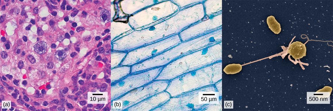 Part a: Human cheek cells as viewed by light microscopy have an irregular round shape and a well-defined nucleus that takes up about one-half of the cell. Part b: Onion skin cells, also viewed by light microscopy, are long and thin with a rectangular shape defined by a cell wall. They are about as wide as a cheek cell, but at least five times as long. The cell wall and nucleus are well defined in the micrograph. The onion cell nucleus is about the same size as the cheek cell nucleus. Part c: In this scann