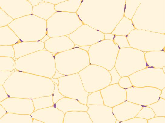 Illustration shows irregularly shaped cells with tiny nuclei clustered next to the cell’s outer membrane.
