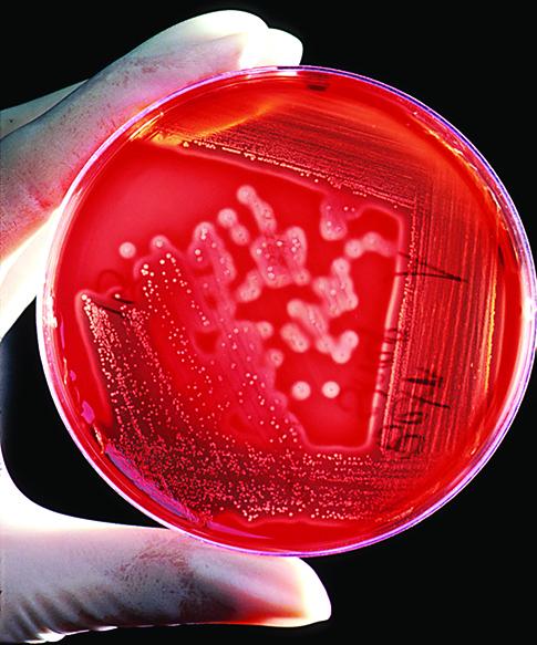 A photo shows a gloved hand holding a petri dish with circular bacteria colonies growing in the growth medium.