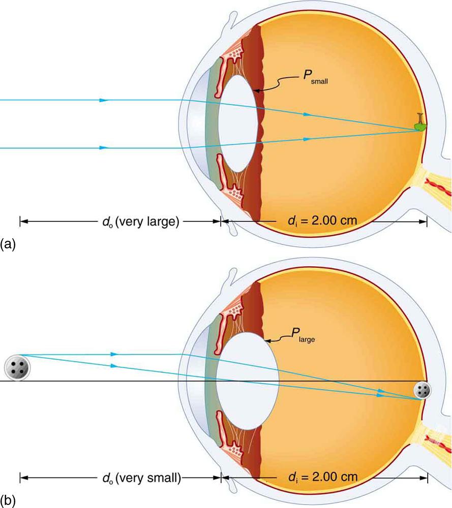 Two cross-sectional views of eye anatomy are shown. In part a of the figure, parallel rays from distant object are entering the eye and are converging on the retina to produce an inverted image of the tree shown above the principle axis. The interior lens of the eye is relaxed and least rounded, given as P small. Distance of image d i is equal to two centimeters, which is the measure of the distance from lens to retina. Distance of object d o is given as very large. In part b of the figure, rays from a bu