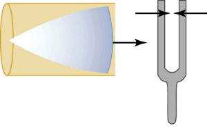 The disturbance is at maximum displacement as it reaches the opening of the tube.