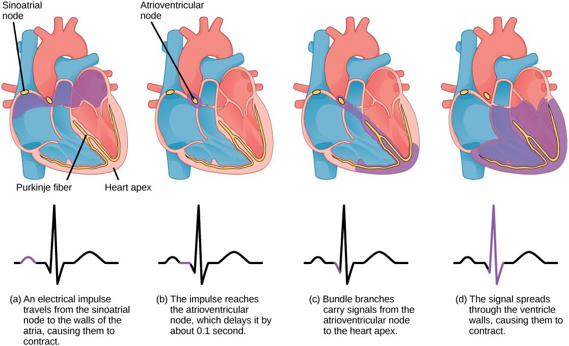 The sinoatrial node is located at the top of the right atrium, and the atrioventricular node is located between the right atrium and right ventricle. The heart beat begins with an electrical impulse at the sinoatrial node, which spreads throughout the walls of the atria, resulting in a bump in the ECG reading. The signal then coalesces at the atrioventricular node, causing the ECG reading to flat-line briefly. Next, the signal passes from the atrioventricular node to the Purkinje fibers, which travel from